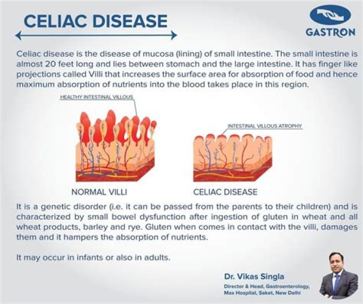 Dave Lee Spouse Struggled With Celiac Disease