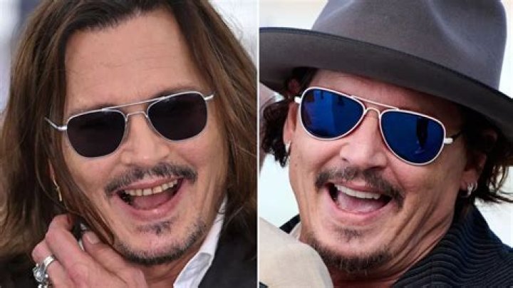 Did Johnny Rotten fix his teeth?