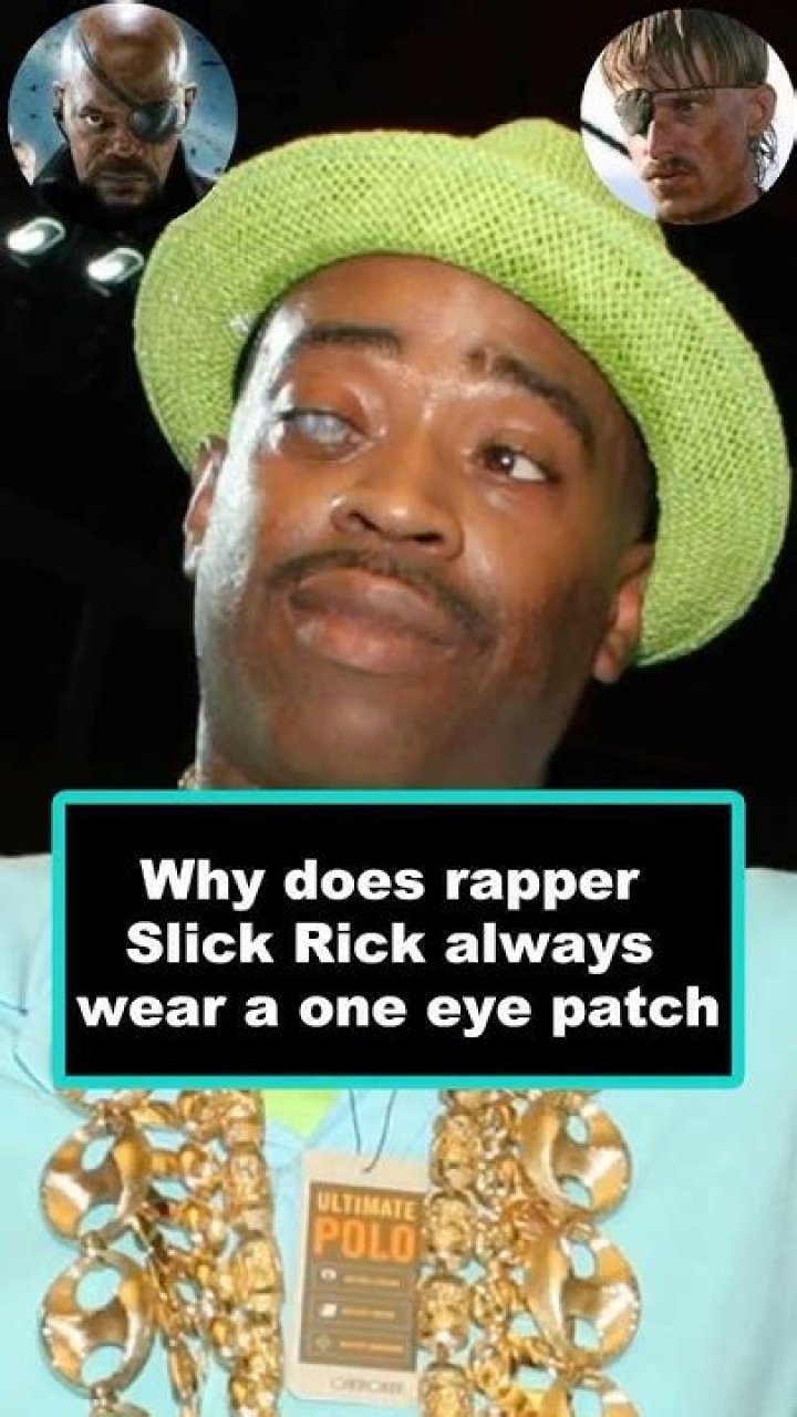 What Happened To Slick Rick Eye, Why Does He Wear Eye Patch?